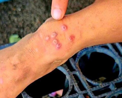 Thái Lan bật cảnh báo khi 23 người tử vong, 732 người bị lây nhiễm 1 căn bệnh, ở Việt Nam cũng đã xuất hiện