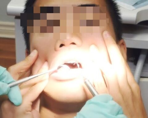 Nam shipper 34 tuổi phát hiện nhiễm HIV sau một cơn sốt, oan ức nói: “Tôi chỉ đi khám răng thôi mà”