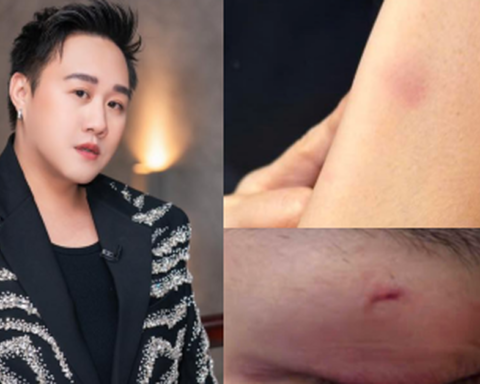 Mới nhất drama hành hung nữ bác sĩ: Trung Quân Idol thông báo ngưng hoạt động rồi xoá post sau 10 phút