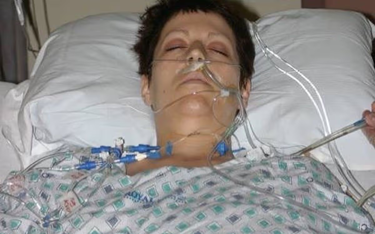 Người phụ nữ 36 tuổi chỉ còn sống được 15 tháng vì hồi nhỏ thích mặc áo của bố