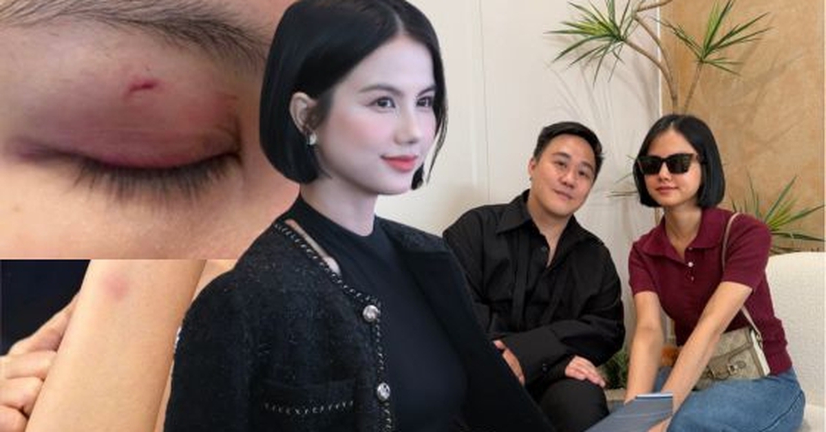 Động thái mới của nữ bác sĩ sau khi Trung Quân idol gặp mặt xin lỗi