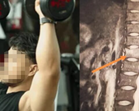 Người đàn ông 34 tuổi xương giòn như bà cụ 60 tuổi vì ngày nào cũng uống 3 cốc loại nước nhiều người không thể sống thiếu