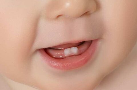 Trẻ chậm mọc răng: Nguyên nhân và dấu hiệu cần lưu ý