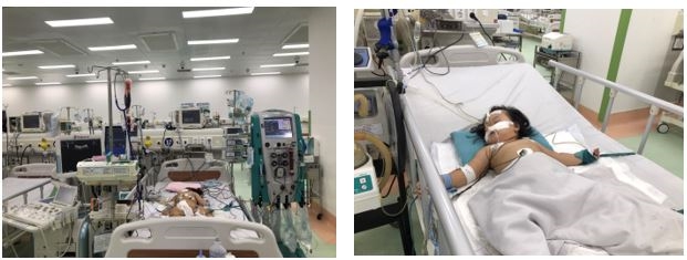 Dấu hiệu bệnh tay chân miệng chuyển bệnh nặng cần đưa đến viện ngay lập tức, kể cả khi trẻ đang chơi- Ảnh 1. Dấu hiệu bệnh tay chân miệng chuyển bệnh nặng cần đưa đến viện ngay lập tức, kể cả khi trẻ đang chơi- Ảnh 1.