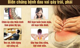 Đau vai gáy là bệnh gì? Nguyên nhân, triệu chứng và cách khắc phục