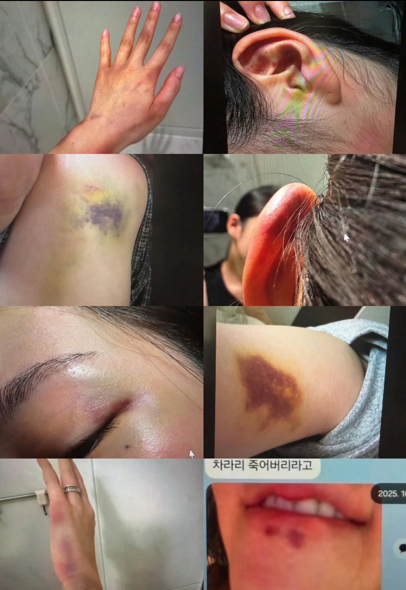 Anh trai Jisoo (BLACKPINK) lại trở thành tâm điểm phẫn nộ: Bị tố bạo hành gia đình, bắt vợ phải quỳ gối xin tha?- Ảnh 2.