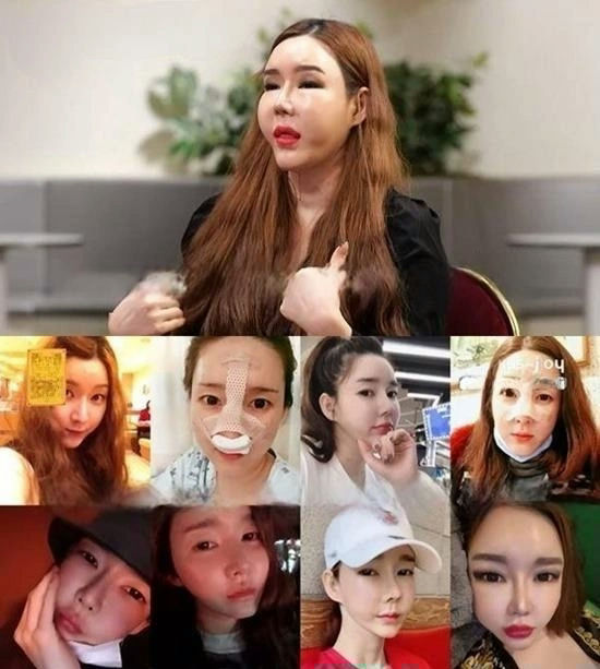 Sao chuyển giới chi 2,5 tỷ "dao kéo" toàn bộ gương mặt, 2 lần chia tay bạn trai trong nước mắt vì không thể sinh con- Ảnh 1.