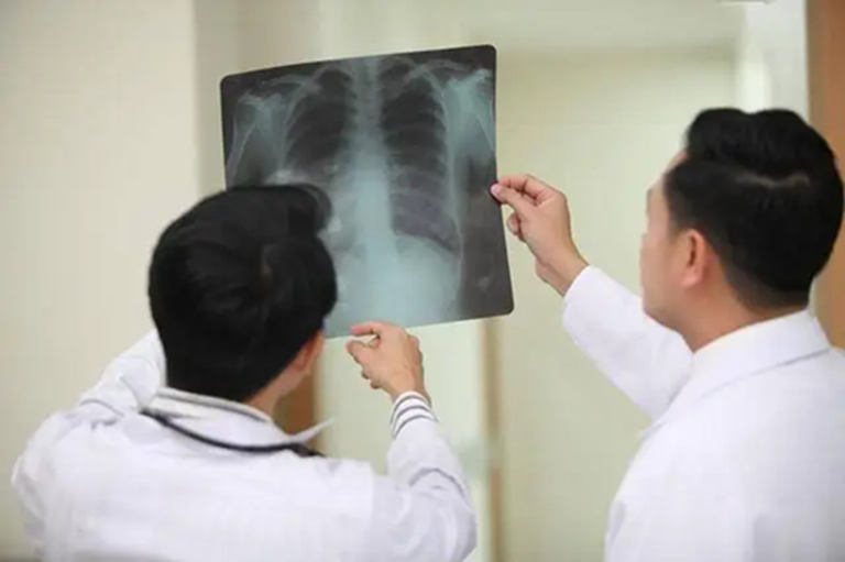 Khi ung thư mới bắt đầu hình thành, người ta thường cảm thấy 3 điều không ổn, nhưng ít ai chú ý đến- Ảnh 3.