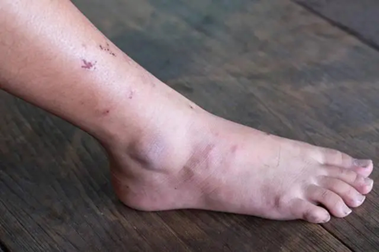 Khi ung thư mới bắt đầu hình thành, người ta thường cảm thấy 3 điều không ổn, nhưng ít ai chú ý đến- Ảnh 2.