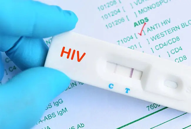 Nam shipper 27 tuổi nhiễm HIV khẳng định 3 năm chưa làm "chuyện ấy", bác sĩ: "Giá như hôm đó anh đừng đi cắt tóc"- Ảnh 3.