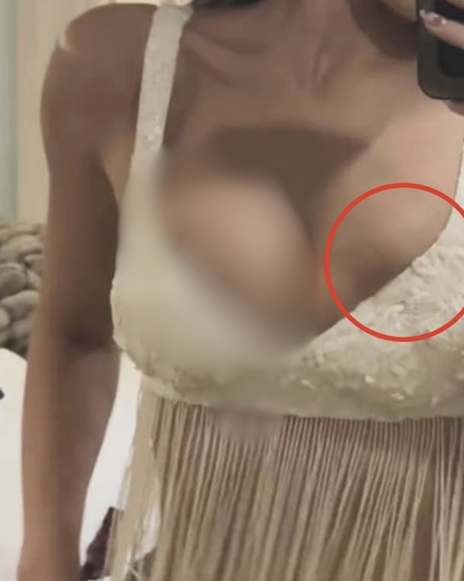 Tình hình của Kylie Jenner sau nghi vấn vỡ túi ngực ở Coachella- Ảnh 7.