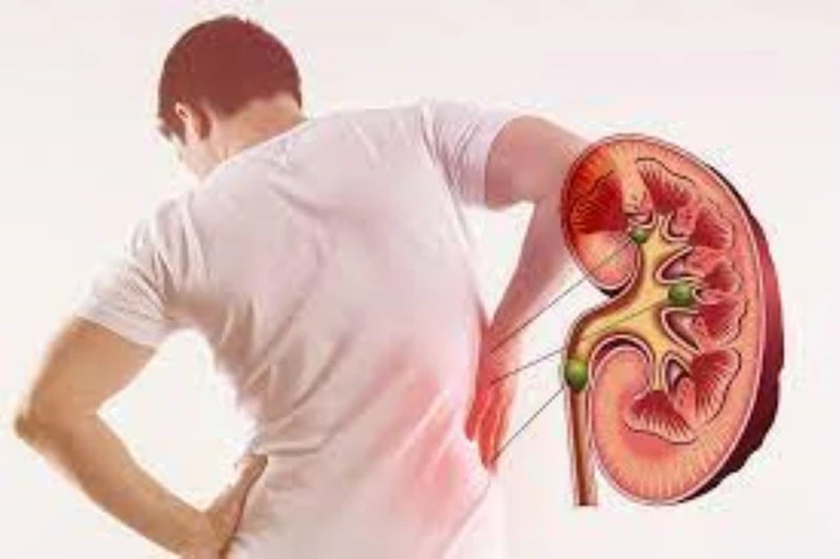 6 thói quen “cực hại thận”, nhiều người làm mỗi ngày mà không biết - Ảnh 2.