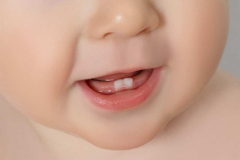 Trẻ chậm mọc răng: nguyên nhân và dấu hiệu cần lưu ý- Ảnh 2.
