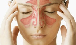 Bệnh viêm xoang có lây không? Chữa thế nào?