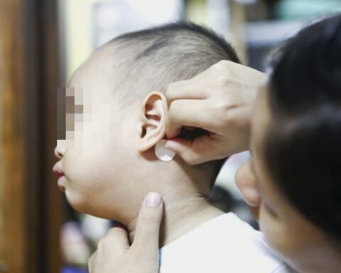 Bé 7 tuổi ở TP.HCM bị rối loạn tâm thần cấp tính: Bác sĩ phát hiện thủ phạm đến từ miếng dán chống say tàu xe