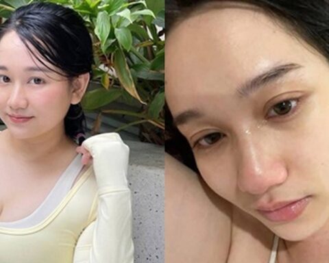 Tình hình hiện tại của Trúc Anh