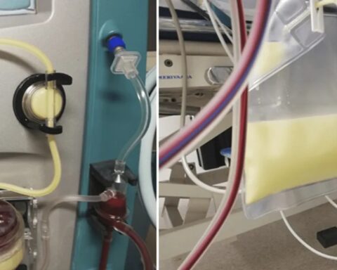 Bé gái 12 tuổi cấp cứu trong tình trạng máu trắng đục, nhớt như mỡ lợn, bác sĩ trách bố mẹ: Chiều kiểu hại con!