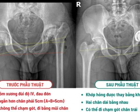 Khách Tây là kỹ sư vượt 10.000km sang 1 bệnh viện ở Việt Nam phẫu thuật