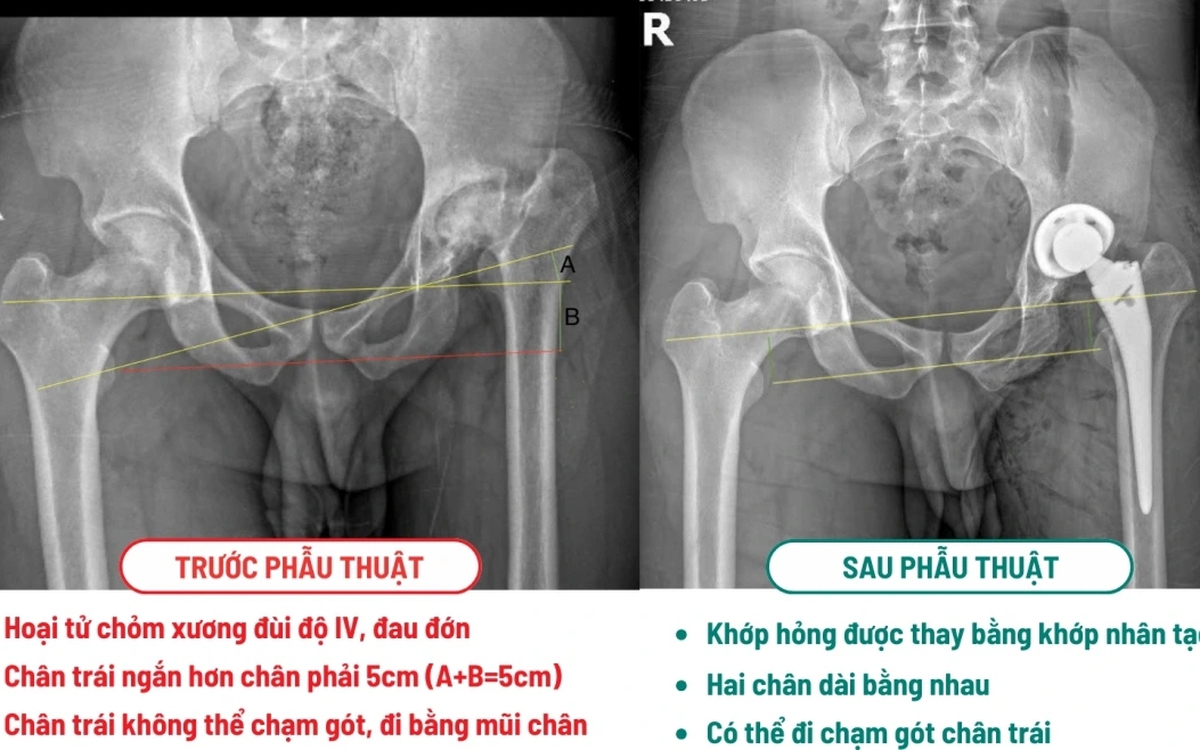Khách Tây là kỹ sư vượt 10.000km sang 1 bệnh viện ở Việt Nam phẫu thuật