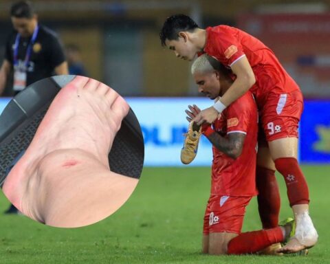 Đình Bắc lộ ảnh cổ chân sưng biến dạng sau trận vô địch V.League cùng CLB CAHN