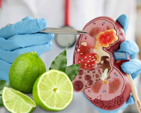 Uống nước chanh có tác dụng “làm sạch thận”?