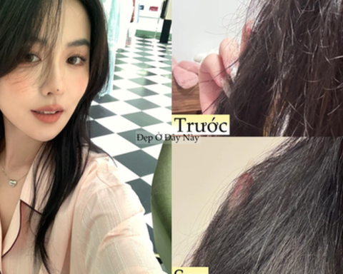 Mái tóc khô xơ, thưa rụng của tôi đã thay đổi bất ngờ nhờ kiên trì với 5 món này