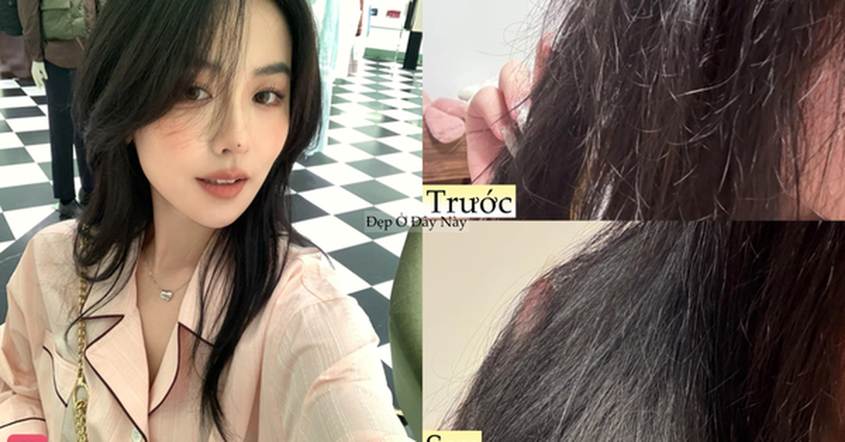Mái tóc khô xơ, thưa rụng của tôi đã thay đổi bất ngờ nhờ kiên trì với 5 món này