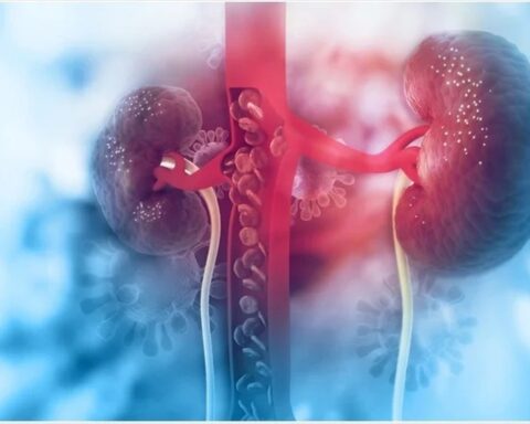 6 cách đào thải acid uric một cách tự nhiên, ngừa gout, bảo vệ thận: Nhiều người chưa biết để làm