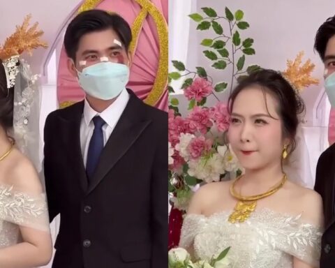 Chú rể đeo khẩu trang, mặt đầy vết thương trong ngày cưới ở TP.HCM: Lý do phía sau