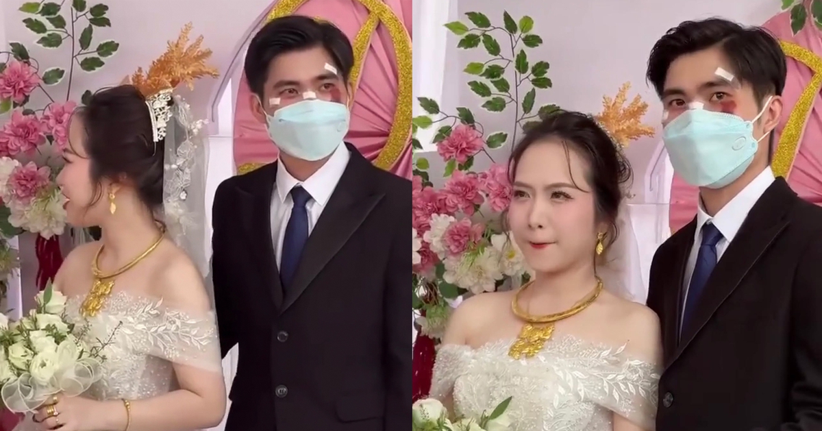 Chú rể đeo khẩu trang, mặt đầy vết thương trong ngày cưới ở TP.HCM: Lý do phía sau