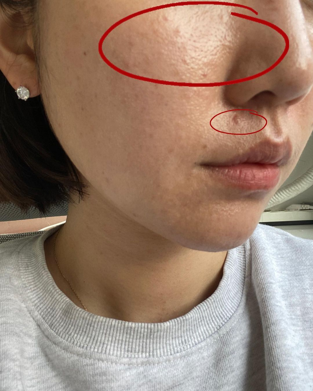 Thay vì đổi sữa rửa mặt, tôi học cách rửa mặt từ bác sĩ da liễu Hàn Quốc giúp da giảm dầu nhờn, láng mịn trong mùa hè- Ảnh 2.