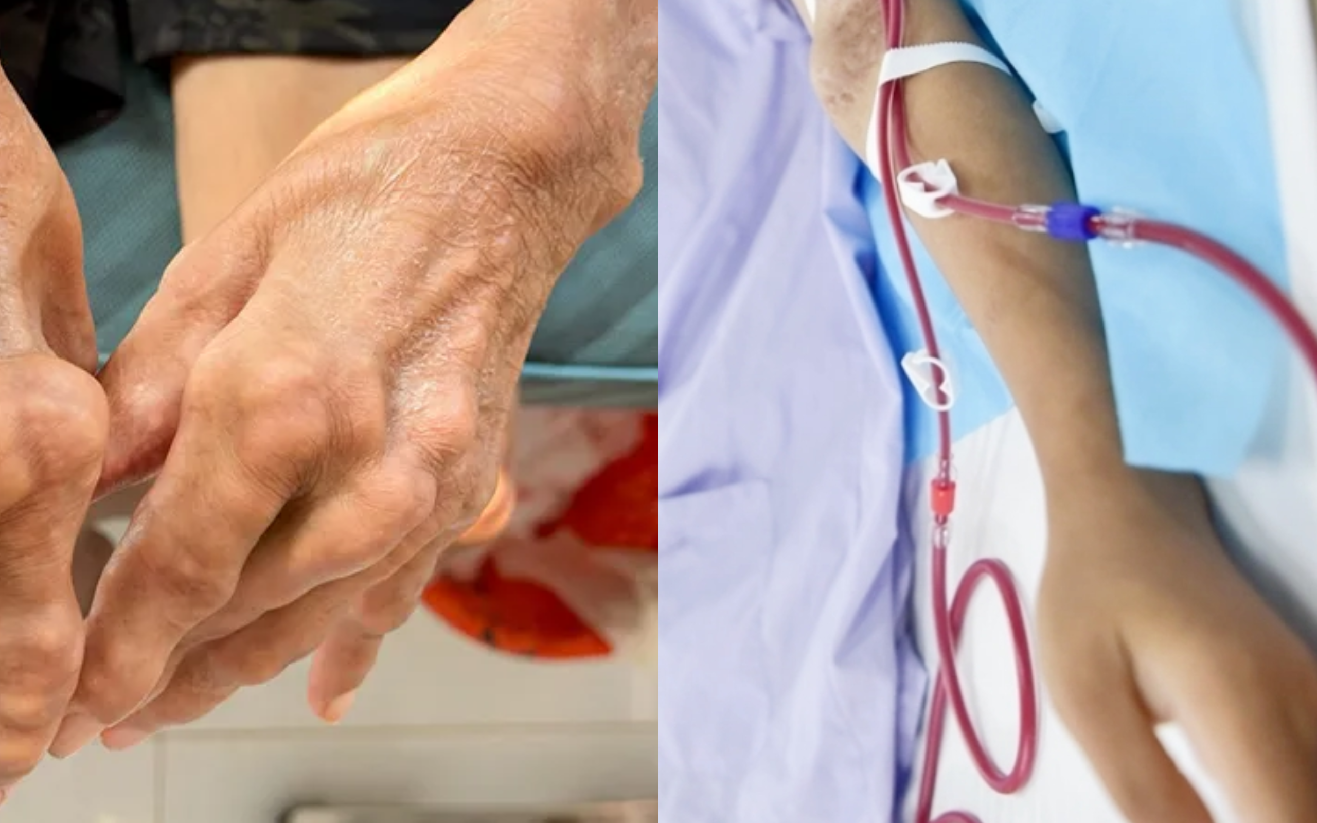 Nhắc nhở: 5 loại đồ uống thường ngày đang ngấm ngầm "bơm" axit uric vào cơ thể, loại đầu chẳng ai ngờ tới - Ảnh 1.