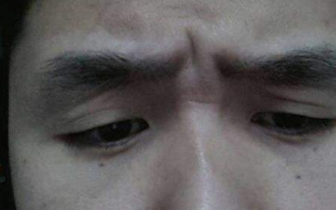 Bé gái 12 tuổi cấp cứu trong tình trạng máu trắng đục, nhớt như mỡ lợn, bác sĩ trách bố mẹ: Chiều kiểu hại con! - Ảnh 2.