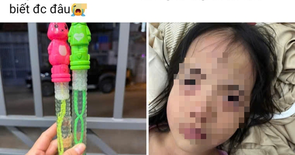 Bé 7 tuổi ở TP.HCM bị rối loạn tâm thần cấp tính: Bác sĩ phát hiện thủ phạm đến từ miếng dán chống say tàu xe - Ảnh 2.