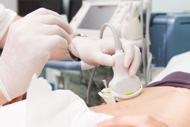 Bỏ qua 2 triệu chứng không đau, người đàn ông 60 tuổi phát hiện ung thư gan giai đoạn cuối- Ảnh 2.