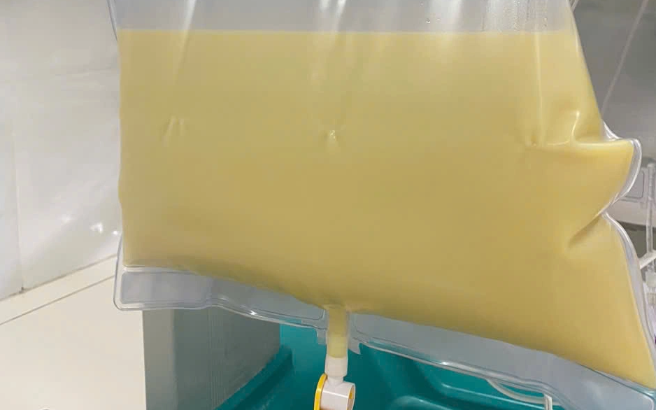 Cặp vợ chồng trẻ cùng mắc 1 bệnh hiếm gặp gây liệt toàn thân, bác sĩ: Rất có thể do cùng sở thích - Ảnh 3.