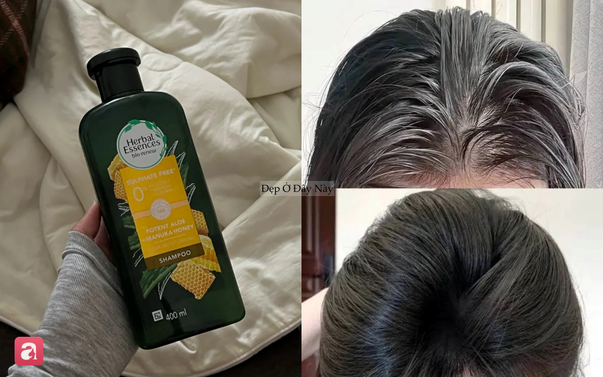Mái tóc khô xơ, thưa rụng của tôi đã thay đổi bất ngờ nhờ kiên trì với 5 món này- Ảnh 3.
