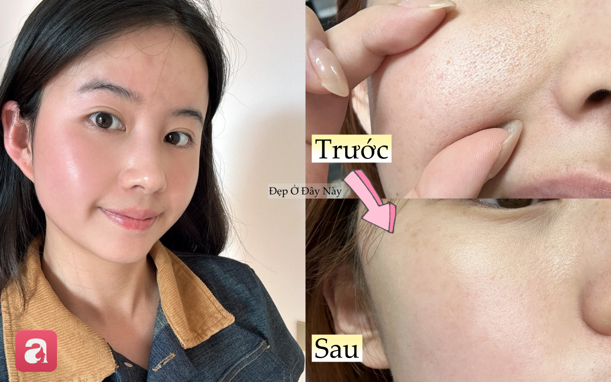 Làn da sần sùi, lỗ chân lông to của nàng blogger đã thay đổi hoàn toàn nhờ cách chăm da ít người chú ý - Ảnh 1.