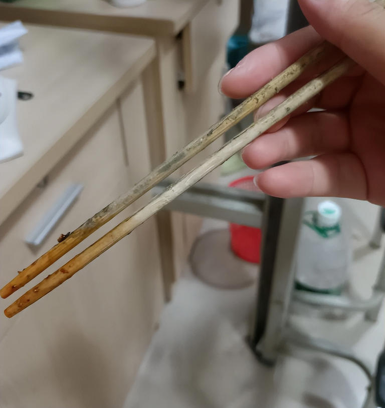 Phát hiện chất kịch độc, gấp thạch tín 68 lần trong dạ dày người phụ nữ mắc ung thư: 5 năm không chịu thay 1 thứ - Ảnh 3.