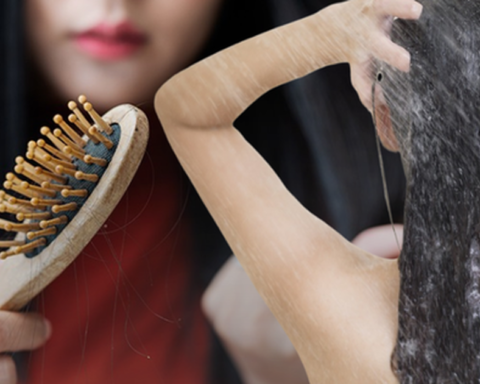 Gội đầu kiểu này cực hại da đầu lại dễ gây hói: Đáng tiếc nhiều người Việt vẫn mắc, thay đổi ngay hôm nay để cứu lấy mái tóc