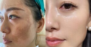 Phụ nữ ngoài 40 đang truyền nhau kiểu dưỡng da mặt nhìn căng bóng và ít chảy xệ hơn