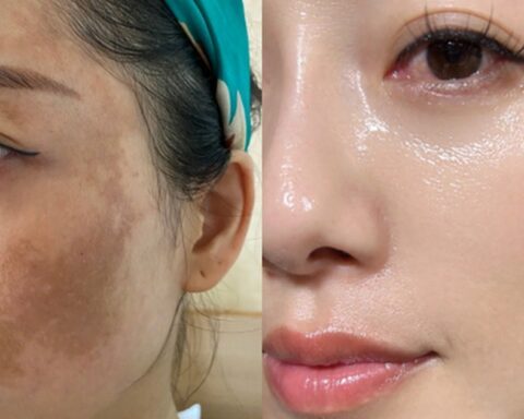 Phụ nữ ngoài 40 đang truyền nhau kiểu dưỡng da mặt nhìn căng bóng và ít chảy xệ hơn