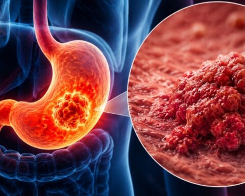 Bác sĩ cảnh báo: 1 THÓI QUEN trước khi ngủ đang âm thầm làm tăng nguy cơ ung thư dạ dày, nhiều người Việt vẫn làm hàng ngày