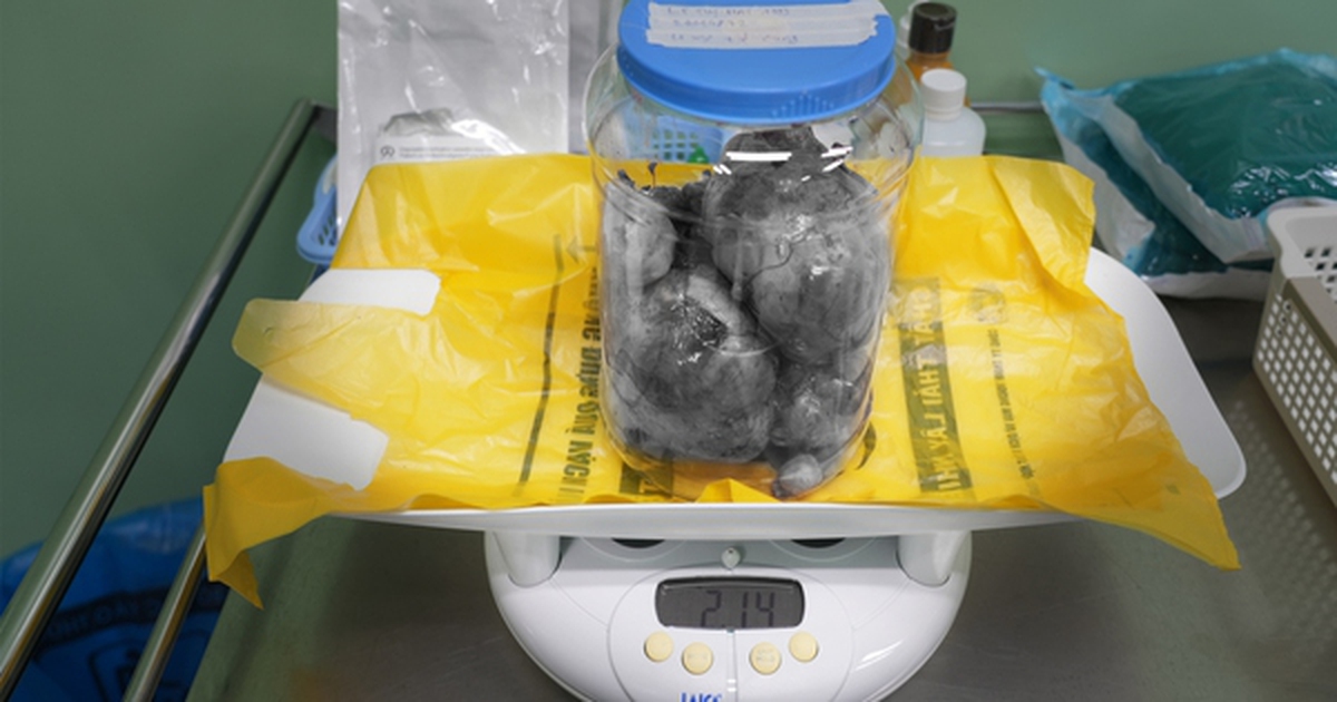 Ca mổ lấy thai đặc biệt: Đón bé 3,3kg chào đời và bóc tách thành công 9 khối u xơ tử cung