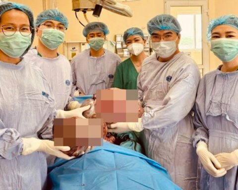 Nữ sinh 16 tuổi mang hai khối u buồng trứng gần 15kg