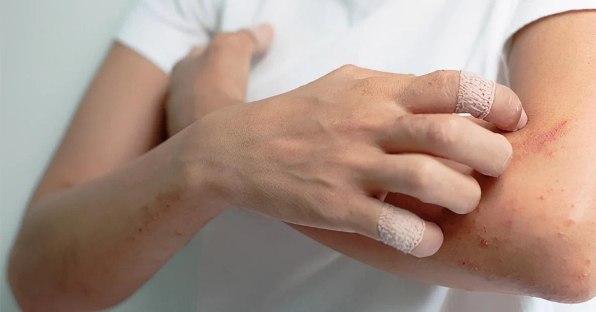 Thức khuya, ăn đồ ăn giao tận nhà suốt nhiều năm, người phụ nữ ân hận nhận “tin dữ” ung thư