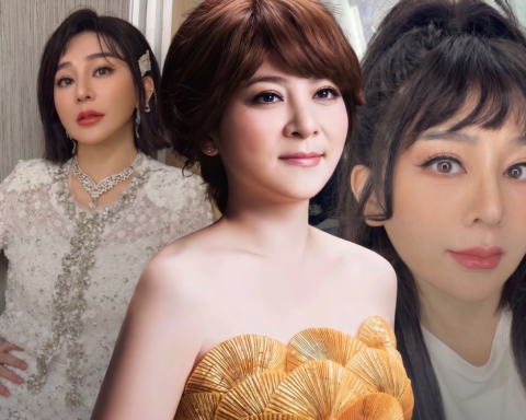 Quyết định làm đẹp thời trẻ khiến một nữ nghệ sĩ trả giá suốt 40 năm: Chiếc mũi biến dạng theo cách không ai ngờ