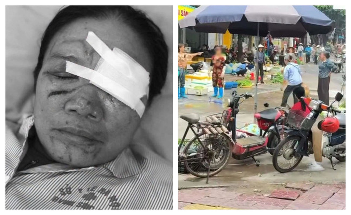 Người phụ nữ bán rau bị xịt nước, chảy máu mắt ở Phú Thọ: Con trai lên tiếng, mong làm rõ trách nhiệm