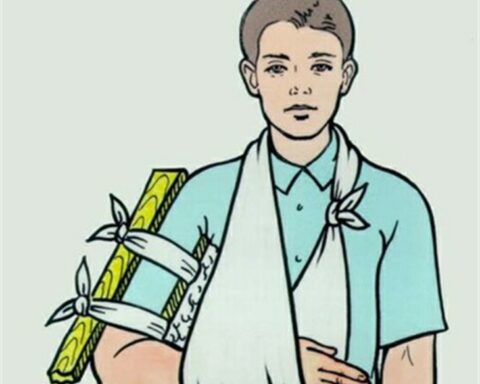 Gãy xương ở trẻ dịp hè: Đừng chủ quan sau chấn thương