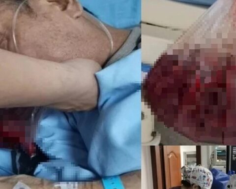 Người đàn ông nôn ra hơn 2 lít máu trong 5 phút, bác sĩ cảnh báo: 4 thói quen ăn uống “phá nát” dạ dày